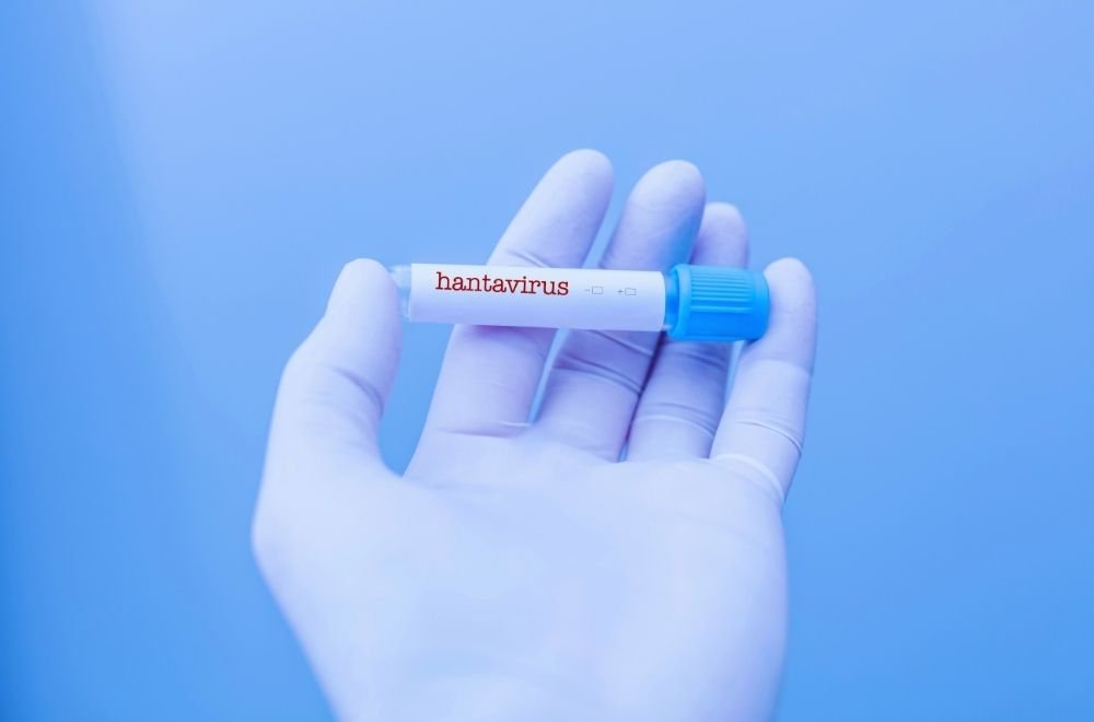 Hantavirus